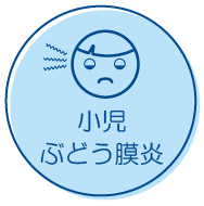 小児ぶどう膜炎